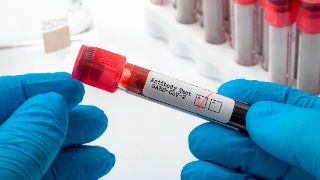 Corona Antikörper Test